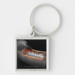 Llavero Vista de un globo angioplaty en una arteria