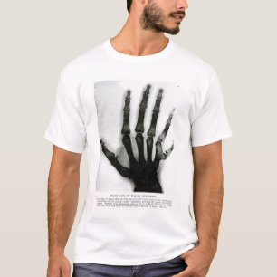 Mano de rayos X con camiseta de dedo extra