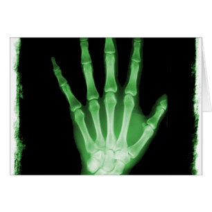 Mano verde del esqueleto de la radiografía