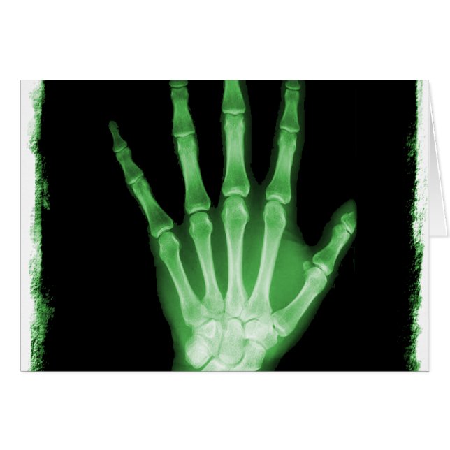 Mano verde del esqueleto de la radiografía (Anverso (Horizontal))