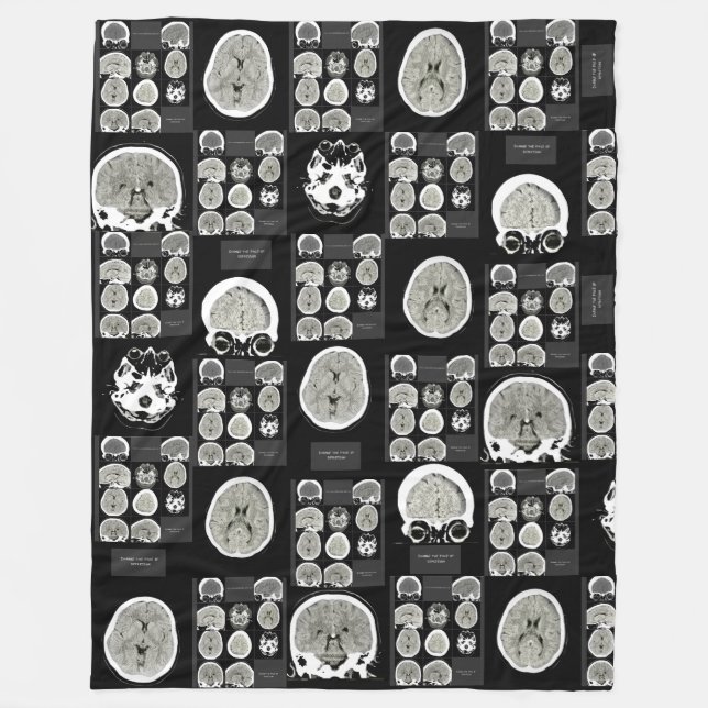 Manta Polar CT Scan_this es depression_BLK_CTFOD (Anverso)