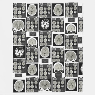 Manta Polar CT Scan_this es depression_CTFOD