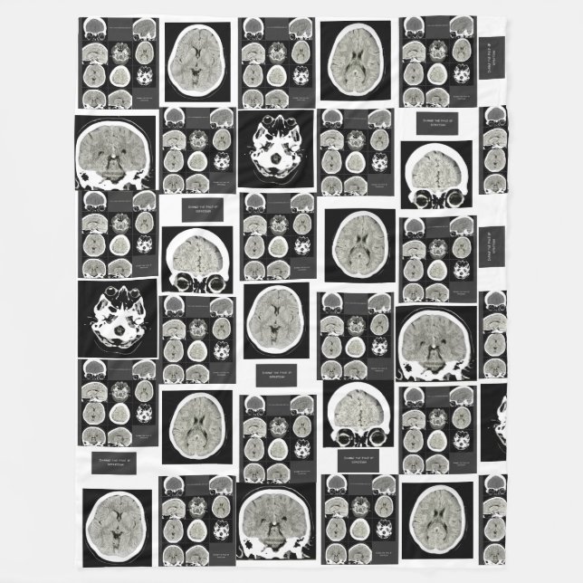 Manta Polar CT Scan_this es depression_CTFOD (Anverso)