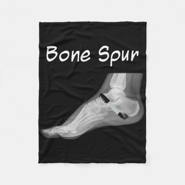 Manta Polar Trump Bone Spur Ink Pen Funny Anti Trump  (Anverso)