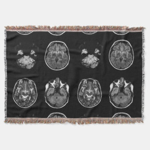 Manta Resonancia magnética cerebral