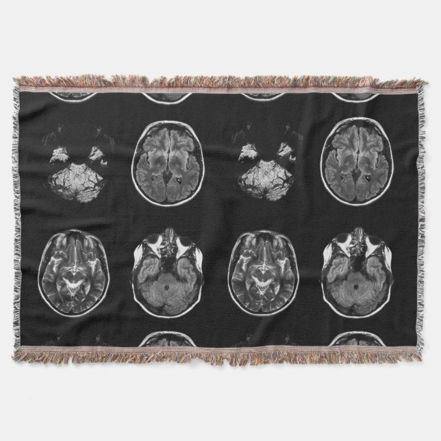 Manta Resonancia magnética cerebral (Anverso)