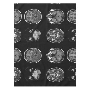 Mantel Resonancia magnética cerebral