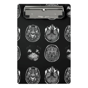 Minicarpeta De Pinza Resonancia magnética cerebral