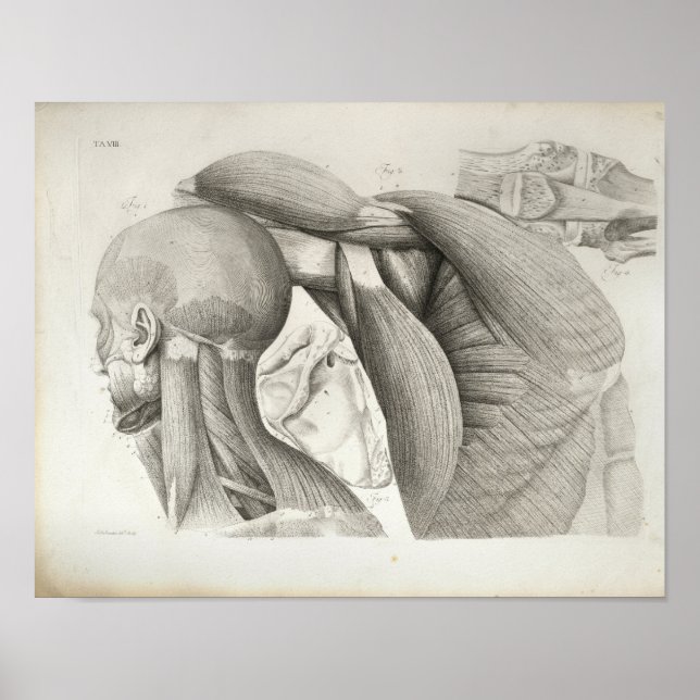 Músculos de hombro de cuello antiguo Impresión méd (Frente)