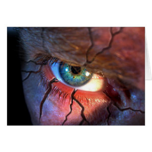 Ojo agrietado