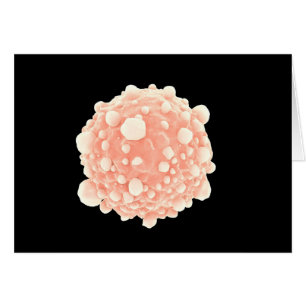Opinión microscópica la célula cancerosa