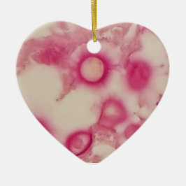 Ornamento criptocócico