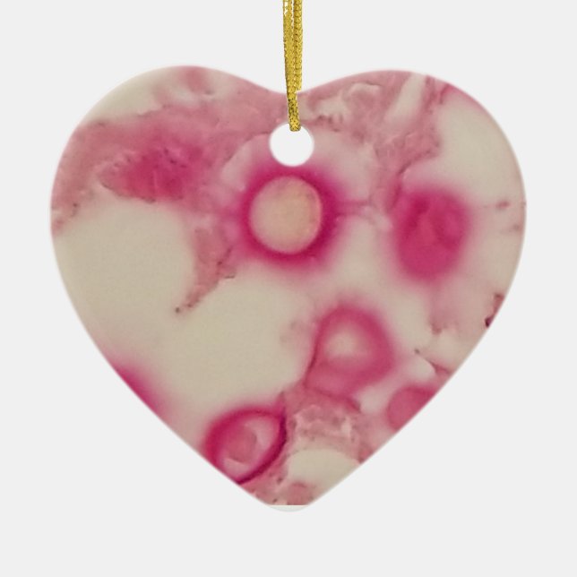 Ornamento criptocócico (Frente)