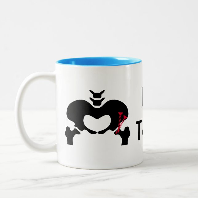 Osteotomía Peri-acetabular clásica de la taza de (Izquierda)