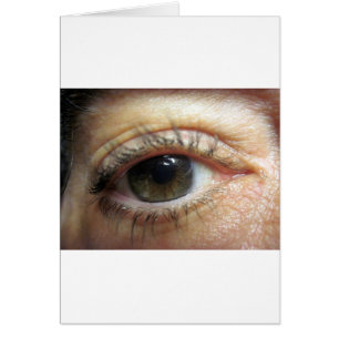 Otro Ojo