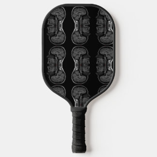 Palas De Pickleball im en la cabeza xray mri scan médico