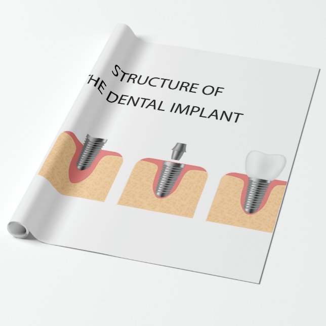 Papel De Regalo Estructura del implante dental (Desenrollado)