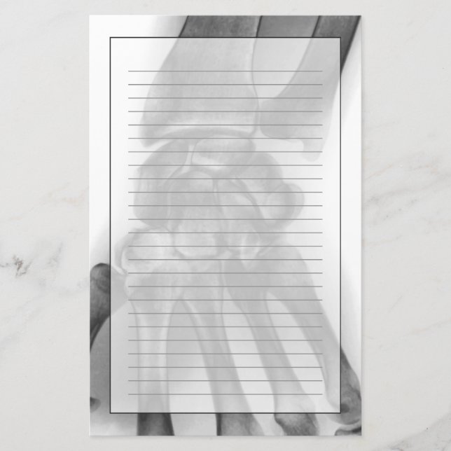 Papelería Muñeca normal, radiografía (Anverso)