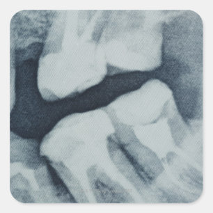 Pegatina Cuadrada Cierre de una radiografía dental