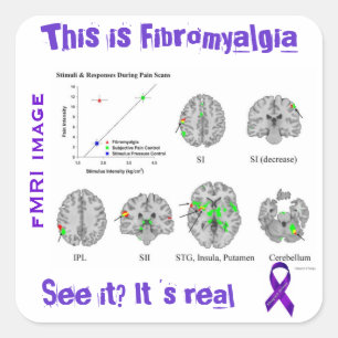 Pegatina Cuadrada El Fibromyalgia es real. Usted puede verlo en un