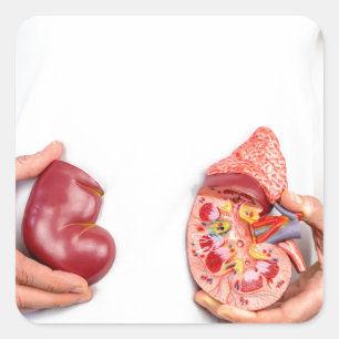 Pegatina Cuadrada Manos sosteniendo el modelo de órgano renal humano