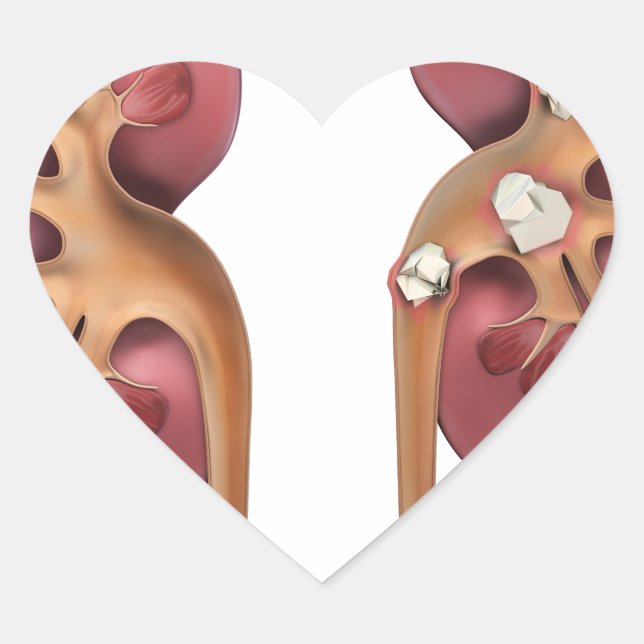Pegatina En Forma De Corazón riñones (Anverso)