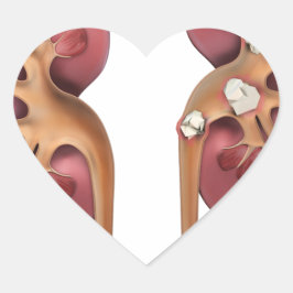 Pegatina En Forma De Corazón riñones