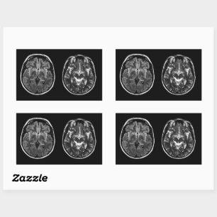 Pegatina Rectangular Exploración de mri cerebrales