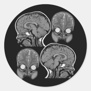 PEGATINA REDONDA ¡CEREBROS! (MRI)