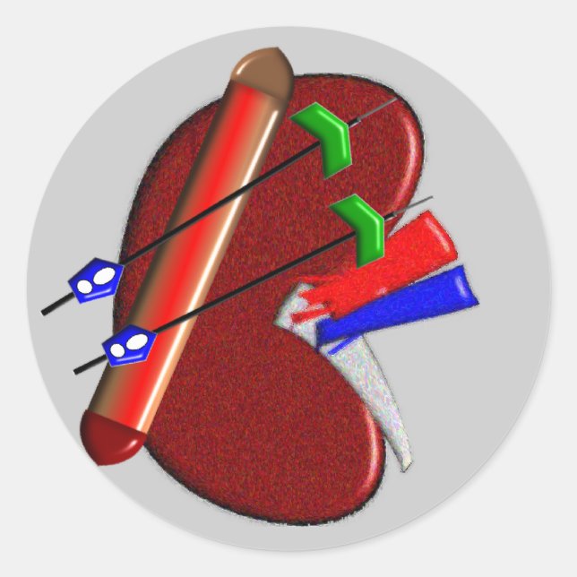 Pegatina Redonda Diálisis Y Regalos De Diseño Renal (Anverso)