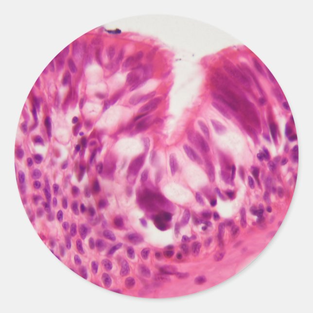 Pegatina Redonda Etelio cilínico bajo el microscopio. (Anverso)