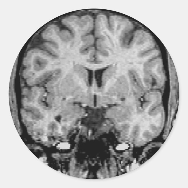 Pegatina Redonda Resonancia magnética cerebral, trozo coronal (Anverso)