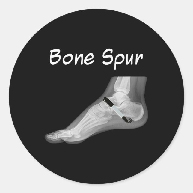 Pegatina Redonda Trump Bone Spur Ink Pen Funny Anti Trump  (Anverso)