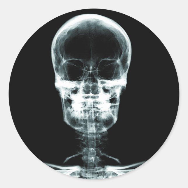 PEGATINA REDONDA VISIÓN DE RAYOS X SKELETON SKULL - ORIGINAL (Anverso)