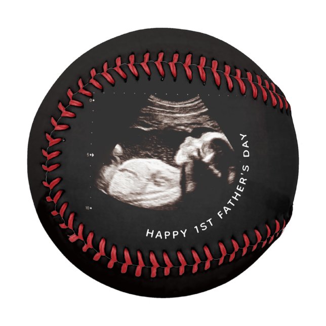 Pelota De Béisbol Foto de sonograma del primer Personalizado del día (Anverso izquierdo)