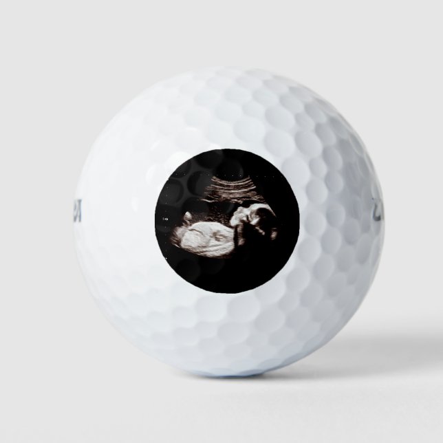 Pelotas De Golf Embarazo Sonograma Ultrasonido Foto Regalo Masculi (Anverso)