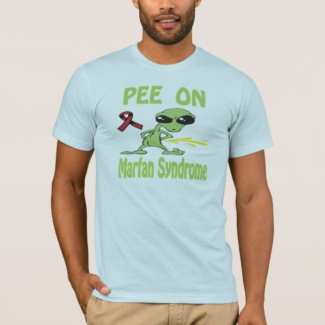 Pis en la camisa del síndrome de Marfan (Anverso)