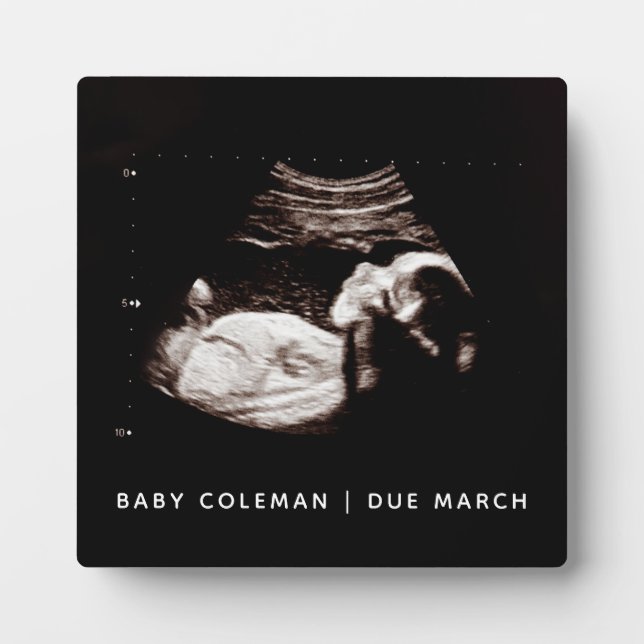 Placa Expositora Sonograma de bebé de embarazo Fotografía de ultras (Frente)