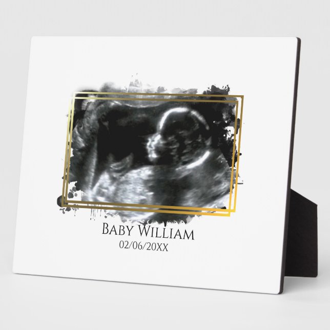 Placa Expositora Sonograma de ultrasonido de bebé esperado (Lado)