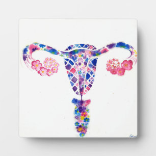 Placa Expositora Uterus