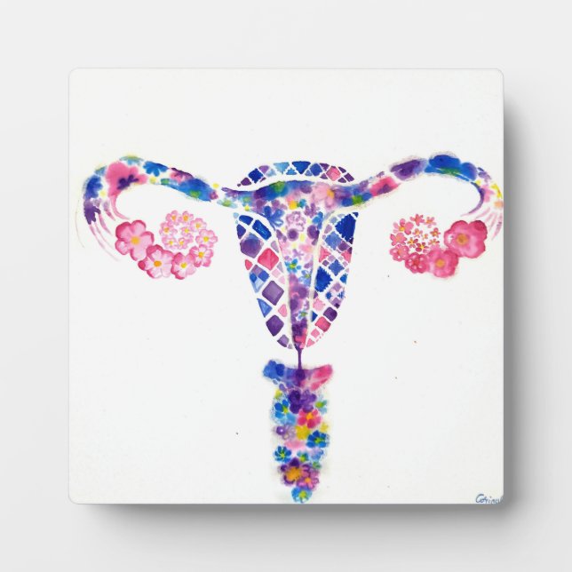 Placa Expositora Uterus (Frente)