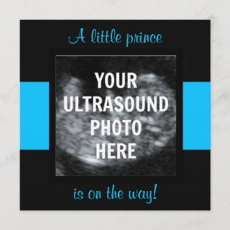 Plantilla de fotografía de ultrasonido personaliza