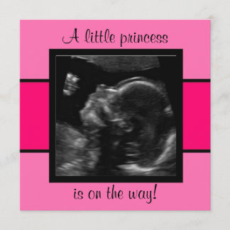 Plantilla de fotografía personalizada para ultraso