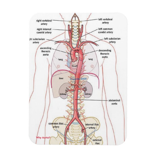 ¡¡POR QUÉ AORTA!! Imanes (Vertical)