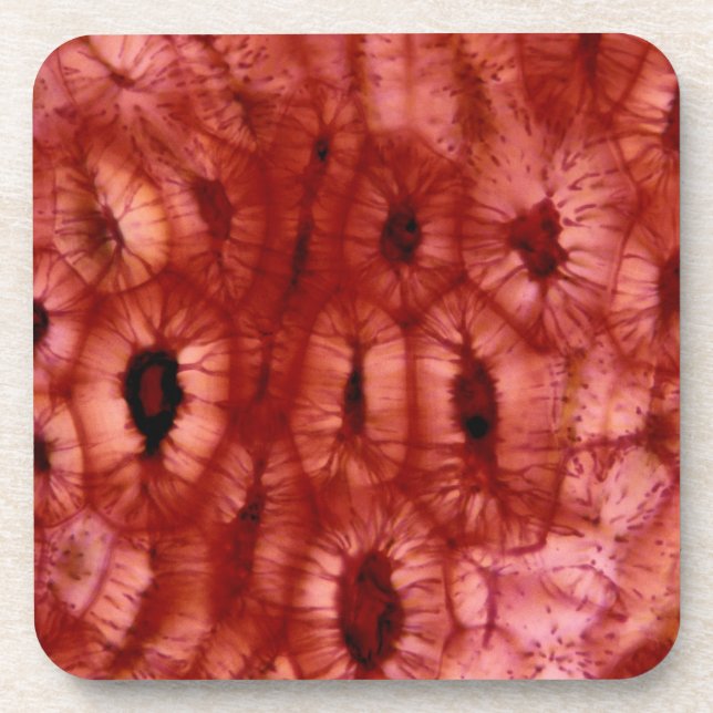 Posavasos Células de Sclerenchyma de un hoyo de la cereza (Frente)