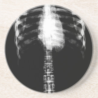 POSAVASOS DE ARENISCA COSTILLAS ESQUELÉTICAS DEL TORSO DE LA RADIOGRAFÍA