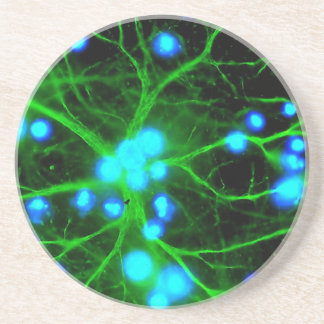 Posavasos De Arenisca El Astrocyte es células de Glial asteroides en el
