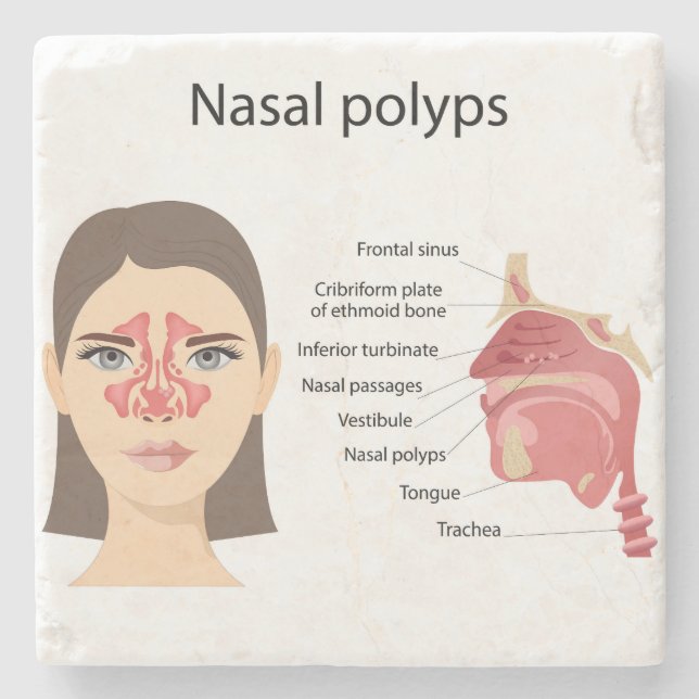 Posavasos De Piedra Sinuses sobre fondo blanco (Anverso)