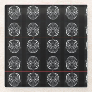 Posavasos De Vidrio im en la cabeza xray mri scan médico