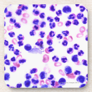 Posavasos Infección de la staph